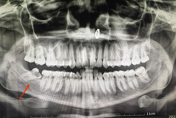 Dental Treatments