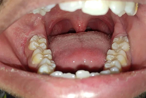 Dental Treatments