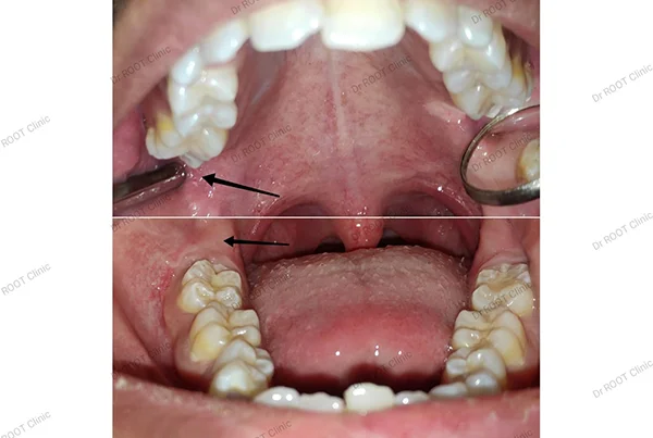Dental Treatments