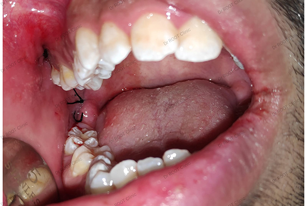 Dental Treatments
