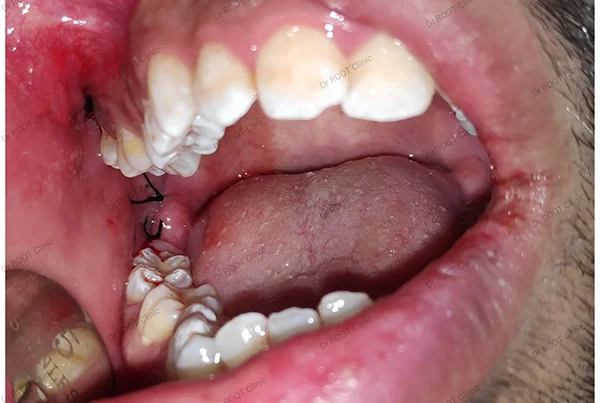 Dental Treatments