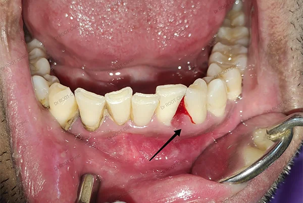 Dental Treatments