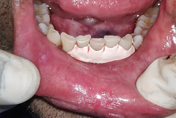 Dental Treatments