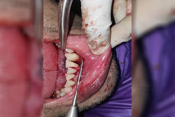 Dental Treatments