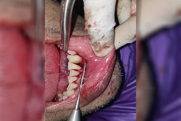 Dental Treatments