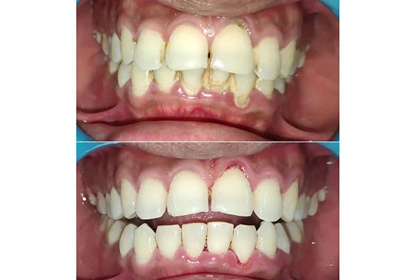 Dental Treatments