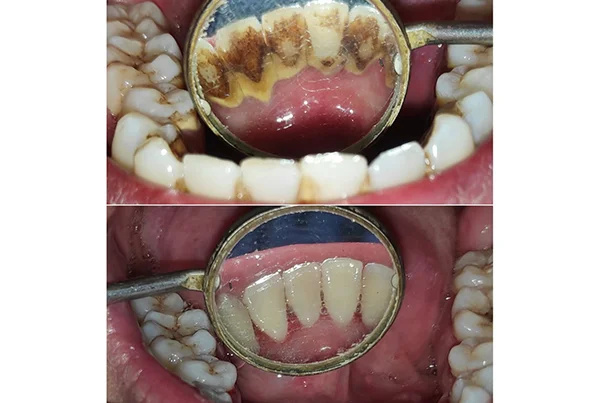 Dental Treatments