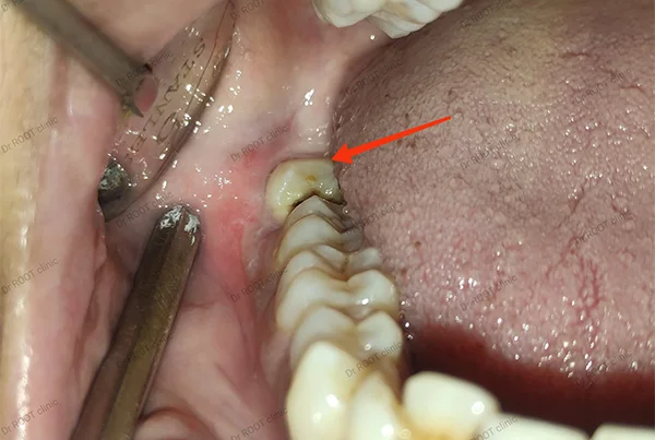 Dental Treatments
