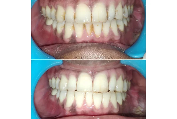 Dental Treatments