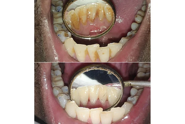 Dental Treatments