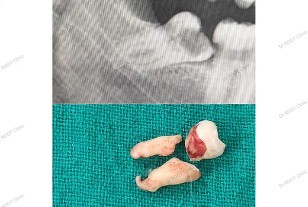 Dental Treatments