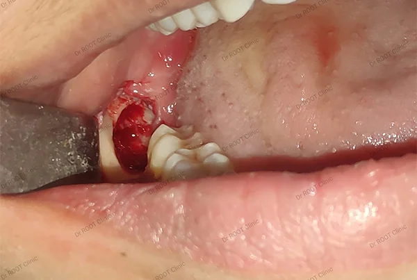 Dental Treatments