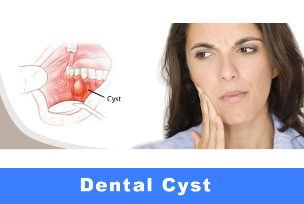 Cyst and Tumor Surgery
