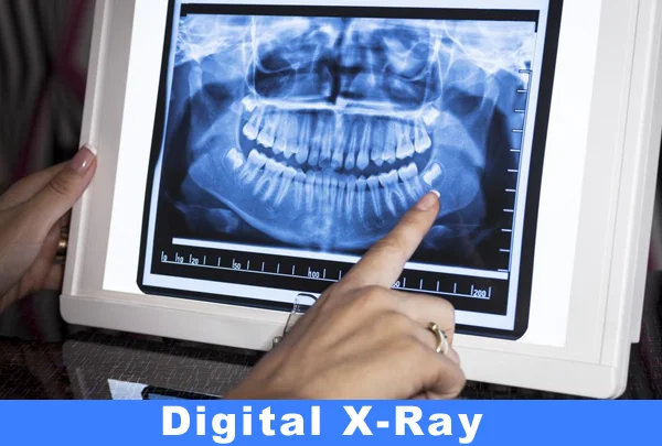 Digital X-Ray