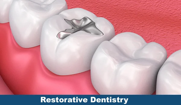 Restorative Dentistry