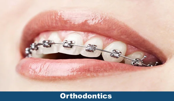 Orthodontics
