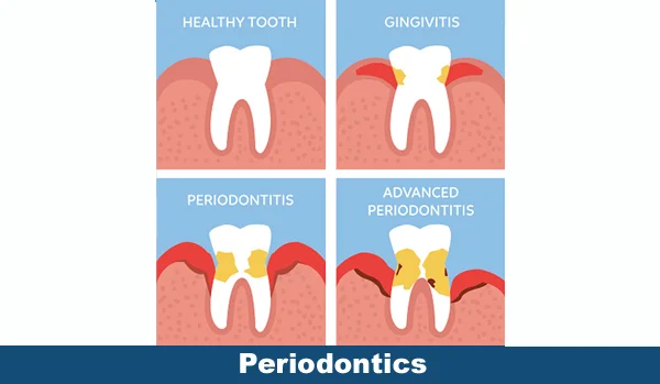 Periodontics