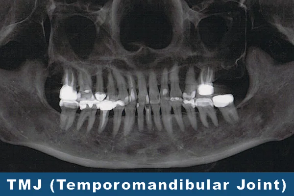 Oral Maxillofacial Radiology (OMR)